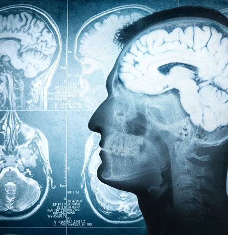 UCD's Neuromuscular Systems Lab