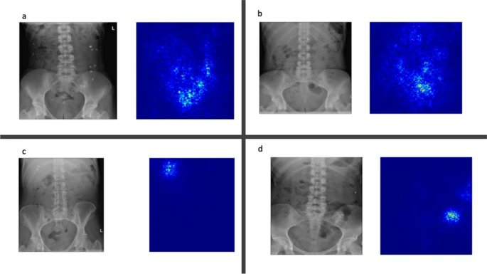 Radiology image